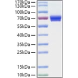 SDS-PAGE - Recombinant Human CD25 Protein (C-terminal Human Fc and His Tag) (A330282) - Antibodies.com