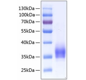 SDS-PAGE - Recombinant Human CD25 Protein (C-terminal His Tag) (A330283) - Antibodies.com