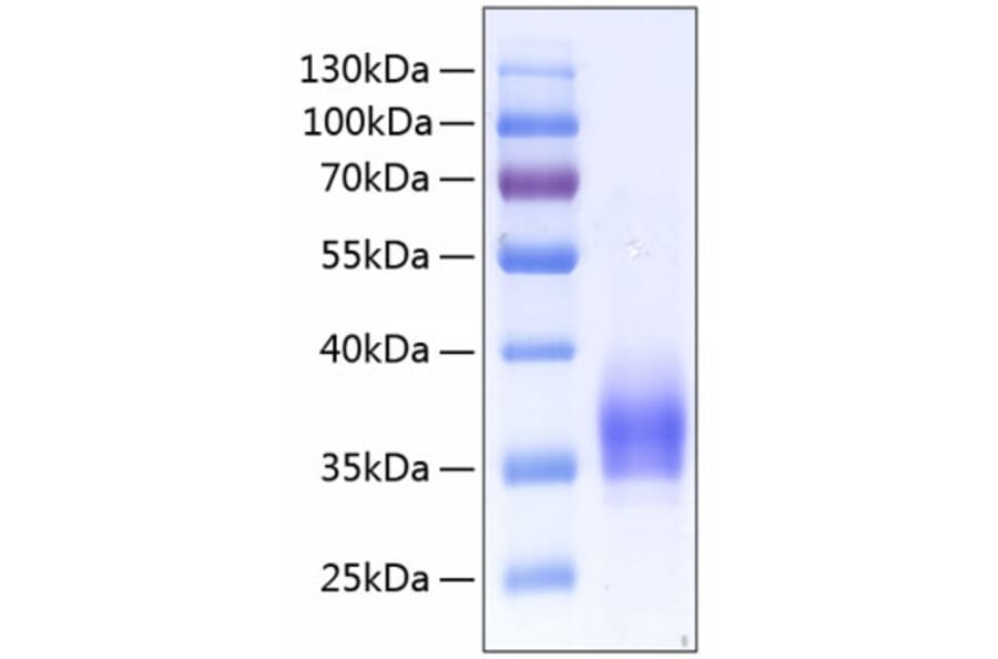 SDS-PAGE - Recombinant Human CD25 Protein (C-terminal His Tag) (A330283) - Antibodies.com