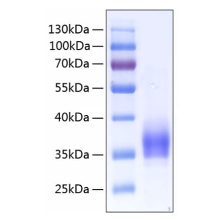 SDS-PAGE - Recombinant Human CD25 Protein (C-terminal His Tag) (A330283) - Antibodies.com