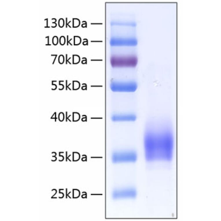 SDS-PAGE - Recombinant Human CD25 Protein (C-terminal His Tag) (A330283) - Antibodies.com