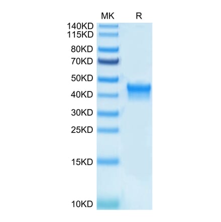 Tris-Bis PAGE - Recombinant Human CD25 Protein (Biotin) (C-terminal His and Avi Tag) (A330284) - Antibodies.com