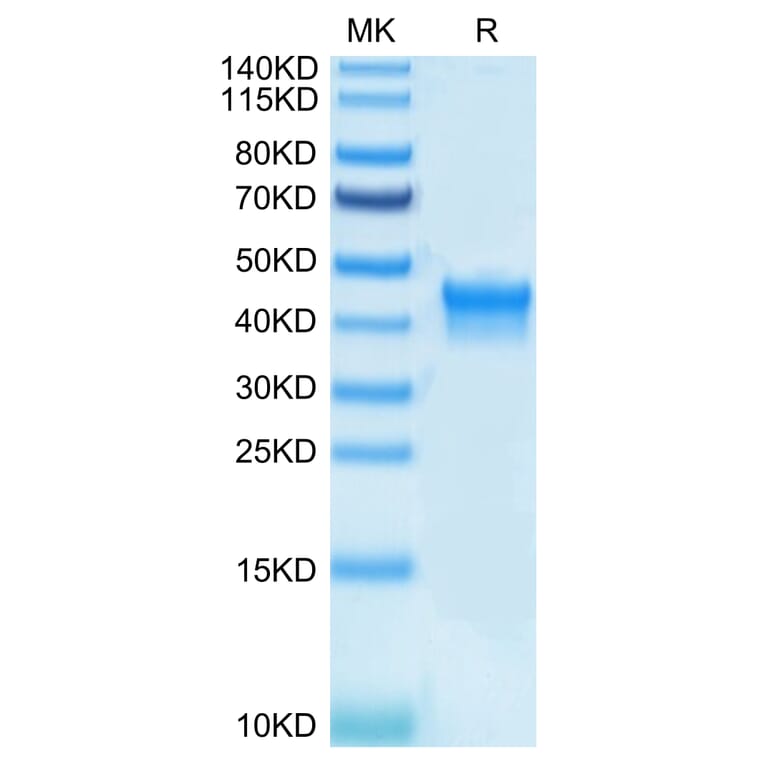 Tris-Bis PAGE - Recombinant Human CD25 Protein (Biotin) (C-terminal His and Avi Tag) (A330284) - Antibodies.com