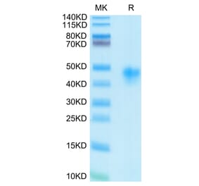 Tris-Bis PAGE - Recombinant Human CD25 Protein (C-terminal His and Avi Tag) (A330285) - Antibodies.com