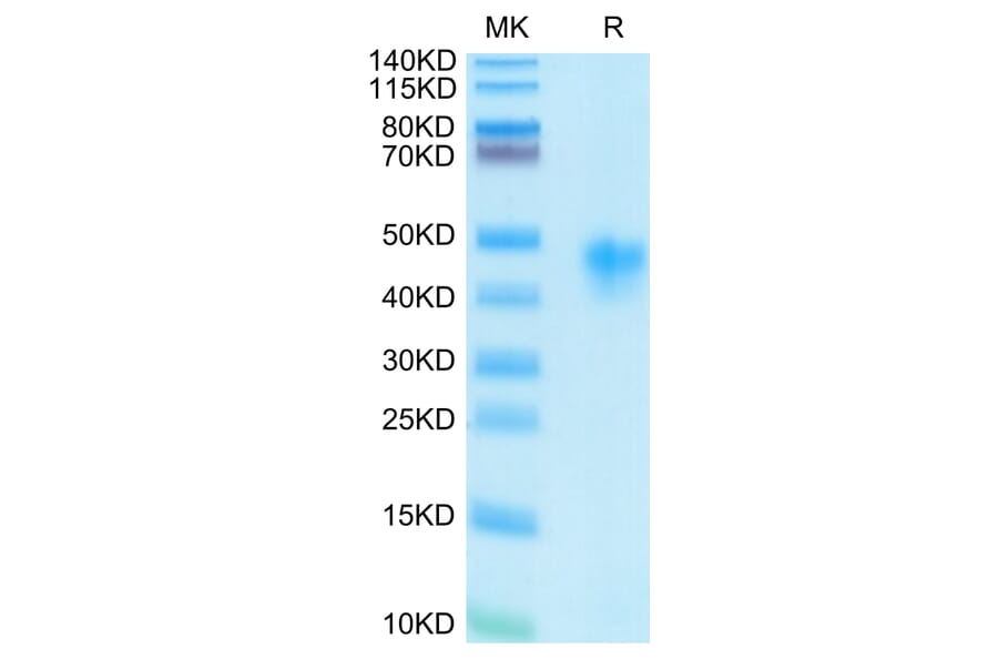Tris-Bis PAGE - Recombinant Human CD25 Protein (C-terminal His and Avi Tag) (A330285) - Antibodies.com