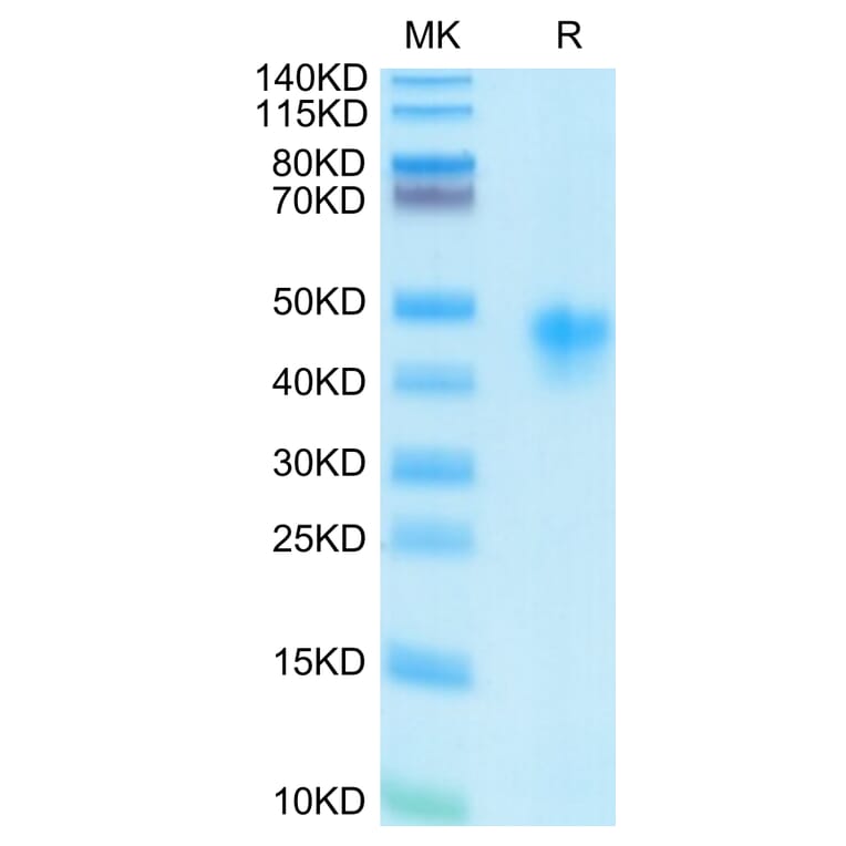 Tris-Bis PAGE - Recombinant Human CD25 Protein (C-terminal His and Avi Tag) (A330285) - Antibodies.com