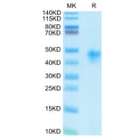 Tris-Bis PAGE - Recombinant Human CD25 Protein (C-terminal His and Avi Tag) (A330285) - Antibodies.com