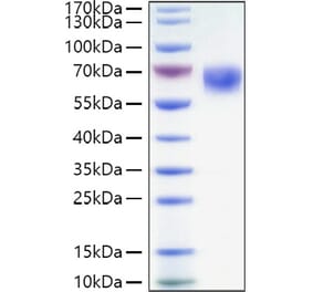 SDS-PAGE - Recombinant Human CD27 Protein (C-terminal Human Fc and His Tag) (A330286) - Antibodies.com