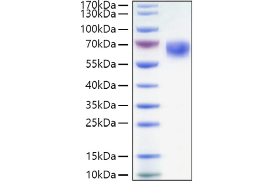 SDS-PAGE - Recombinant Human CD27 Protein (C-terminal Human Fc and His Tag) (A330286) - Antibodies.com