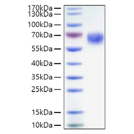 SDS-PAGE - Recombinant Human CD27 Protein (C-terminal Human Fc and His Tag) (A330286) - Antibodies.com