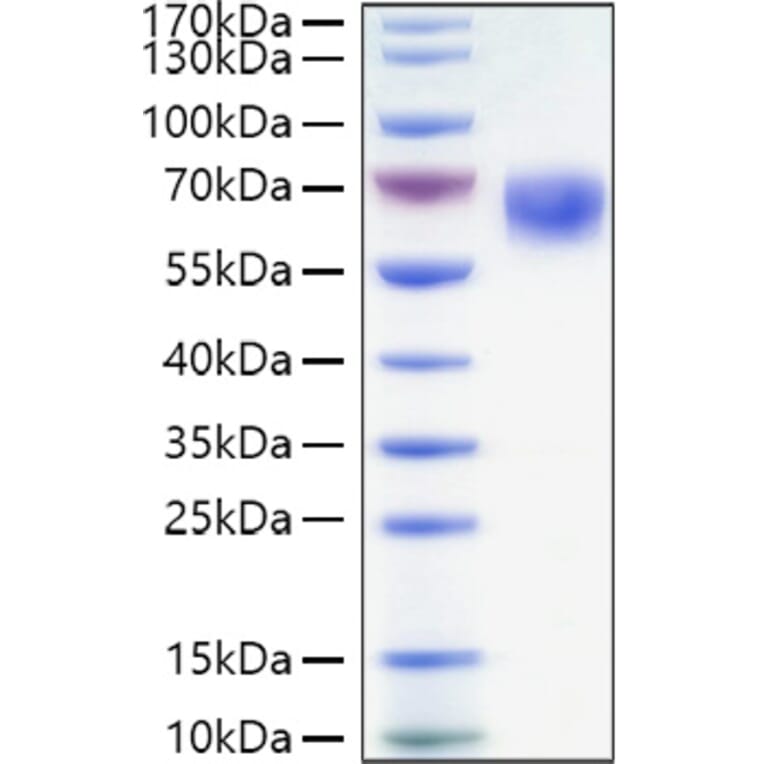 SDS-PAGE - Recombinant Human CD27 Protein (C-terminal Human Fc and His Tag) (A330286) - Antibodies.com
