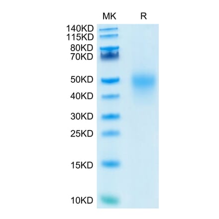 Tris-Bis PAGE - Recombinant Human CD27 Protein (C-terminal His Tag) (A330287) - Antibodies.com