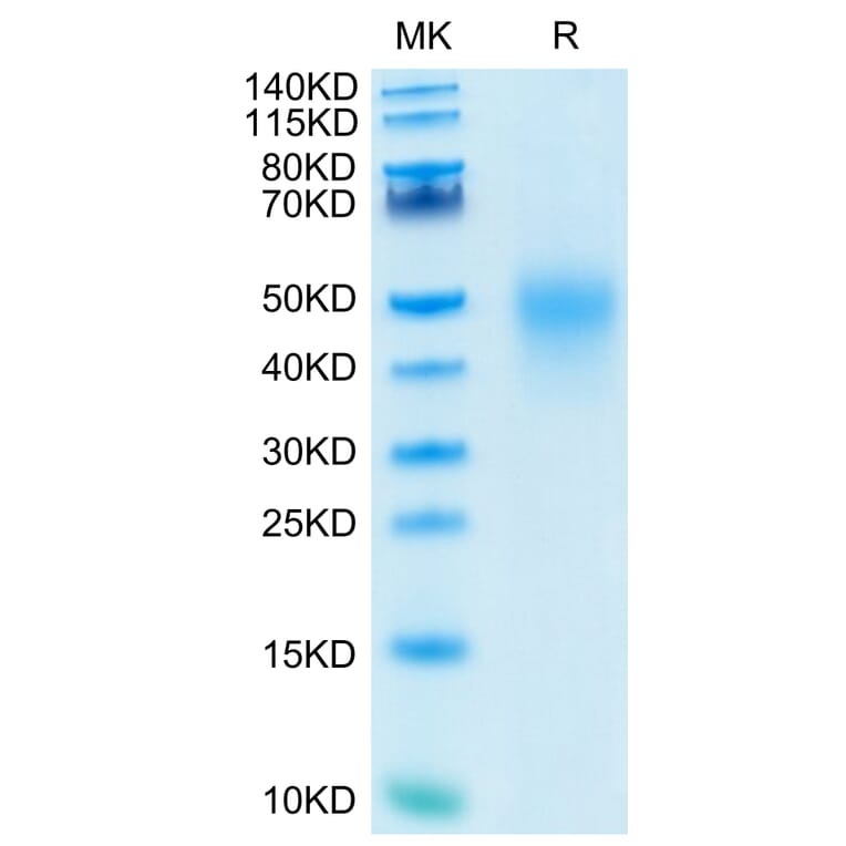 Tris-Bis PAGE - Recombinant Human CD27 Protein (C-terminal His Tag) (A330287) - Antibodies.com