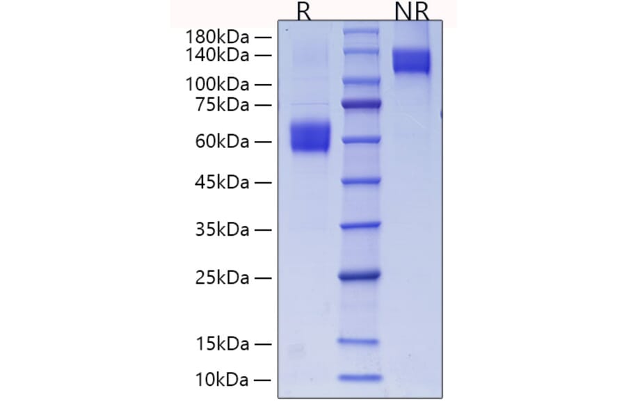 SDS-PAGE - Recombinant Mouse CD28 Protein (C-terminal Human Fc and His Tag) (A330288) - Antibodies.com