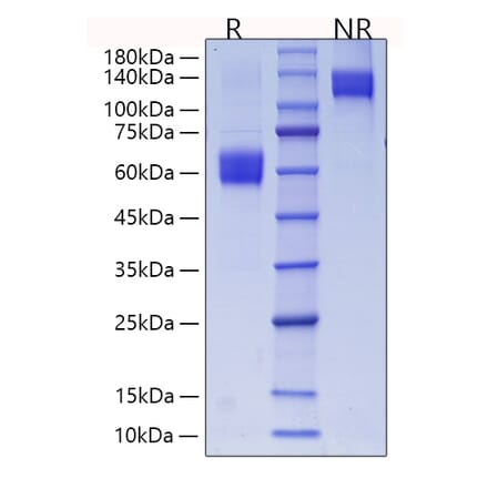 SDS-PAGE - Recombinant Mouse CD28 Protein (C-terminal Human Fc and His Tag) (A330288) - Antibodies.com