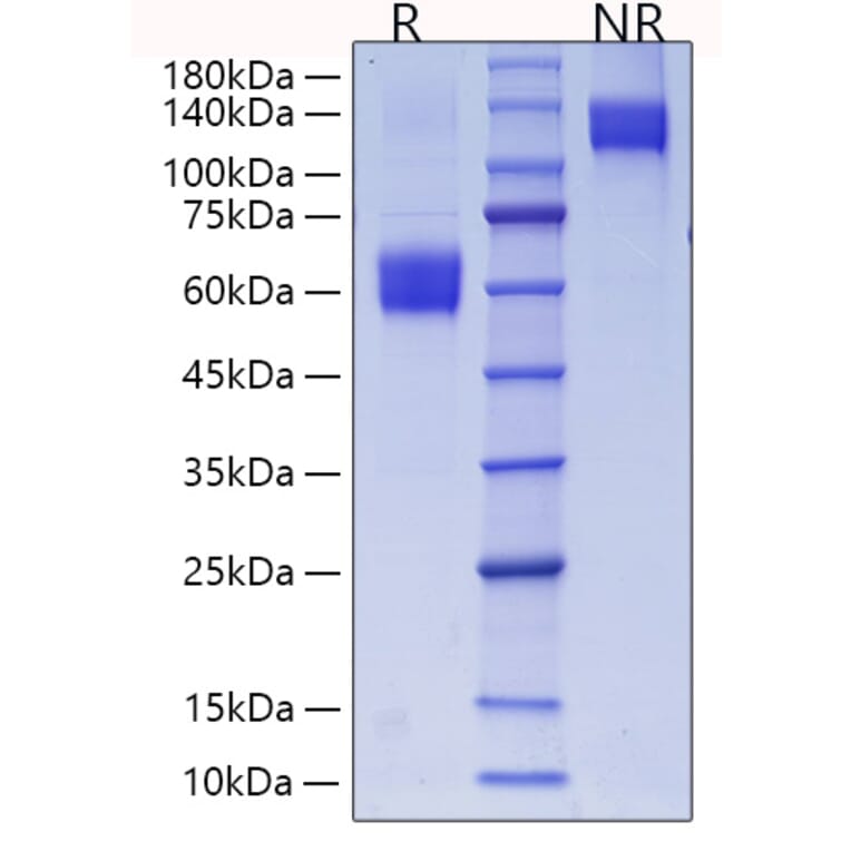 SDS-PAGE - Recombinant Mouse CD28 Protein (C-terminal Human Fc and His Tag) (A330288) - Antibodies.com
