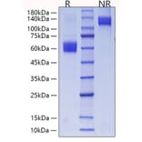 SDS-PAGE - Recombinant Mouse CD28 Protein (C-terminal Human Fc and His Tag) (A330288) - Antibodies.com