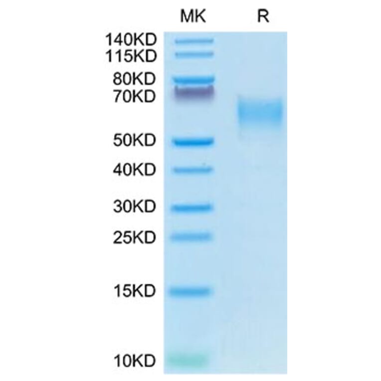 Tris-Bis PAGE - Recombinant Canine CD28 Protein (C-terminal Mouse Fc Tag) (A330289) - Antibodies.com