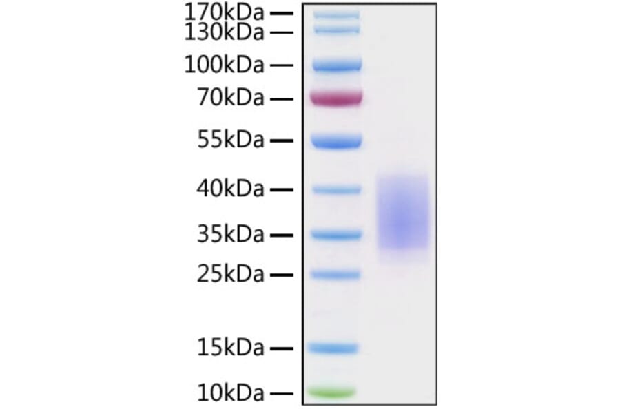 SDS-PAGE - Recombinant Human CD28 Protein (C-terminal His Tag) (A330290) - Antibodies.com