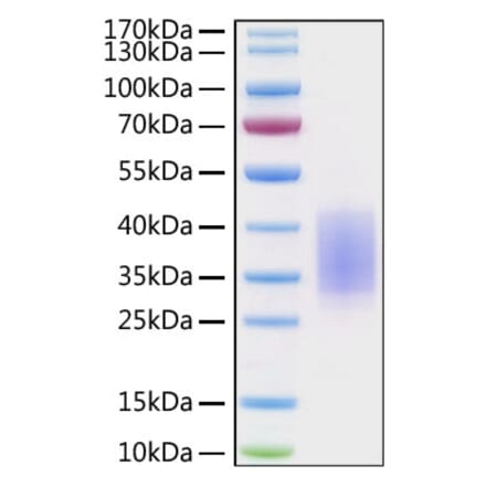SDS-PAGE - Recombinant Human CD28 Protein (C-terminal His Tag) (A330290) - Antibodies.com