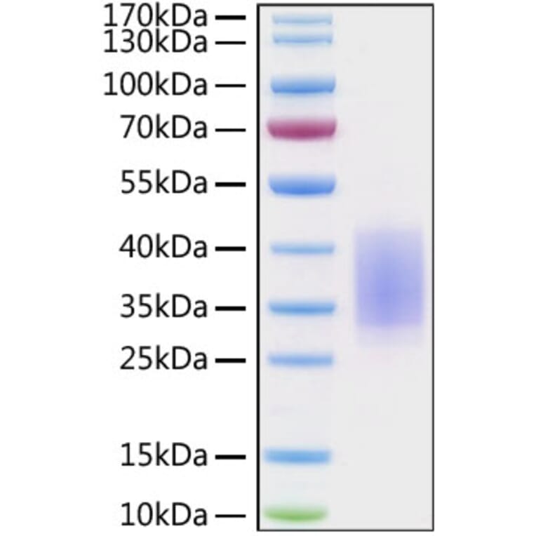SDS-PAGE - Recombinant Human CD28 Protein (C-terminal His Tag) (A330290) - Antibodies.com