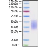 SDS-PAGE - Recombinant Human CD28 Protein (C-terminal His Tag) (A330290) - Antibodies.com