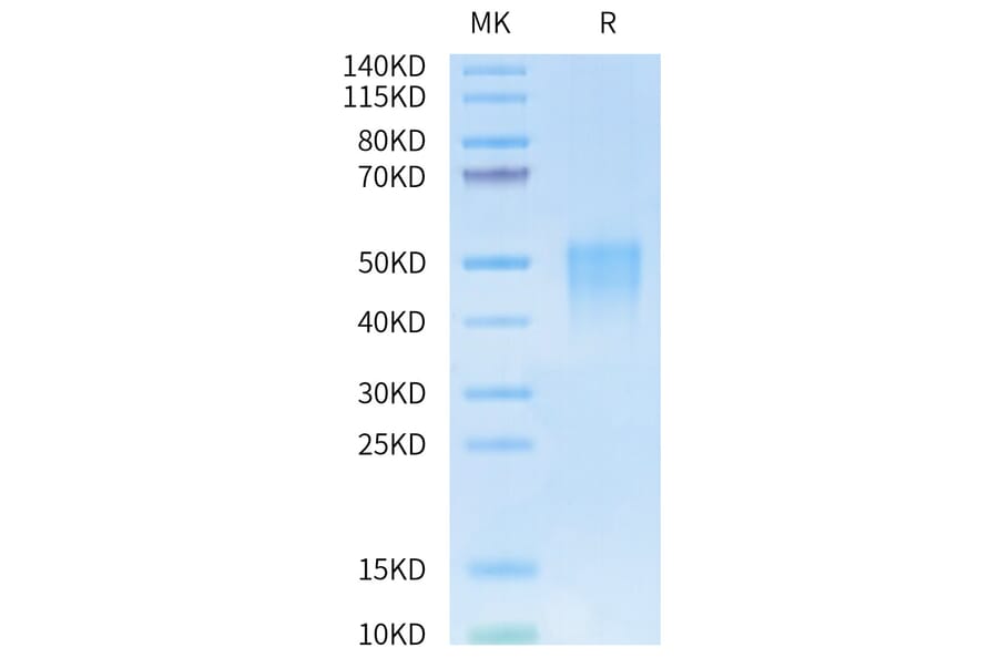 Tris-Bis PAGE - Recombinant Human CD28 Protein (Biotin) (N-terminal His and Avi Tag) (A330291) - Antibodies.com