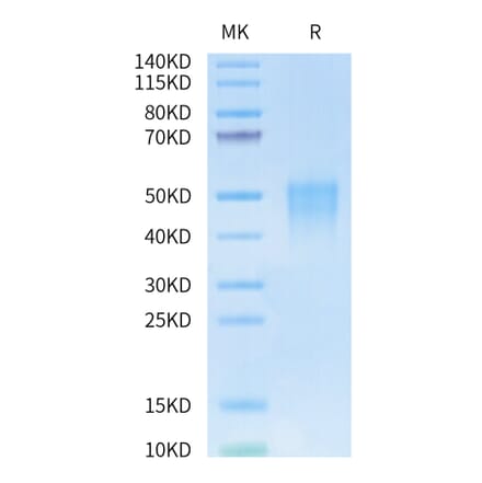 Tris-Bis PAGE - Recombinant Human CD28 Protein (Biotin) (N-terminal His and Avi Tag) (A330291) - Antibodies.com