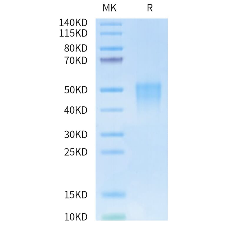 Tris-Bis PAGE - Recombinant Human CD28 Protein (Biotin) (N-terminal His and Avi Tag) (A330291) - Antibodies.com