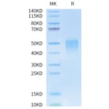 Tris-Bis PAGE - Recombinant Human CD28 Protein (Biotin) (N-terminal His and Avi Tag) (A330291) - Antibodies.com