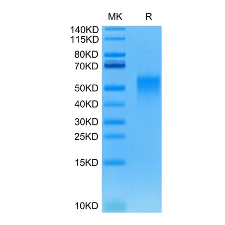 Tris-Bis PAGE - Recombinant Human/Cynomolgus/Rhesus-macaque CD28 Protein (N-terminal His and Avi Tag) (A330292) - Antibodies.com