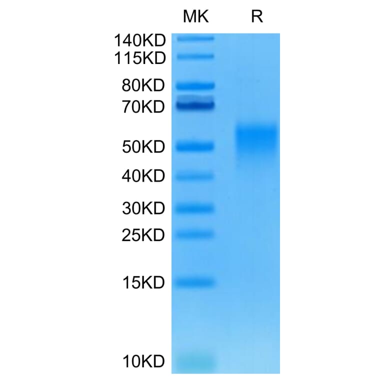 Tris-Bis PAGE - Recombinant Human/Cynomolgus/Rhesus-macaque CD28 Protein (N-terminal His and Avi Tag) (A330292) - Antibodies.com
