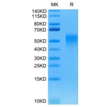 Tris-Bis PAGE - Recombinant Human/Cynomolgus/Rhesus-macaque CD28 Protein (N-terminal His and Avi Tag) (A330292) - Antibodies.com
