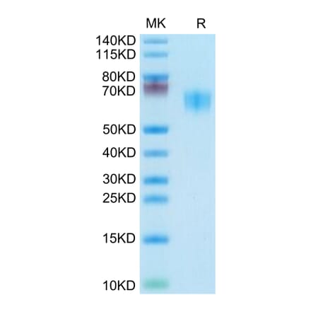 Tris-Bis PAGE - Recombinant Human/Cynomolgus/Rhesus-macaque CD28 Protein (N-terminal Mouse Fc Tag) (A330293) - Antibodies.com