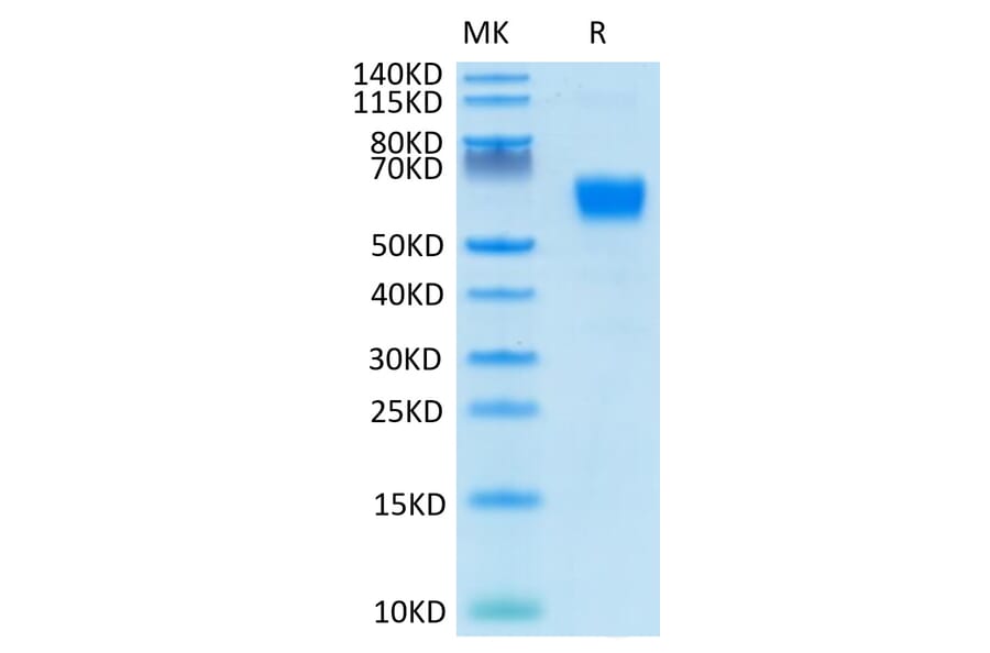 Tris-Bis PAGE - Recombinant Human/Cynomolgus/Rhesus-macaque CD28 Protein (N-terminal Human Fc Tag) (A330294) - Antibodies.com
