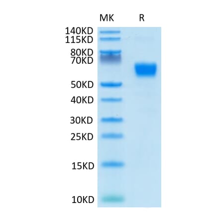 Tris-Bis PAGE - Recombinant Human/Cynomolgus/Rhesus-macaque CD28 Protein (N-terminal Human Fc Tag) (A330294) - Antibodies.com