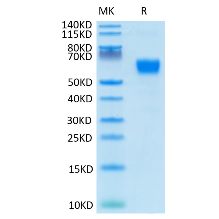 Tris-Bis PAGE - Recombinant Human/Cynomolgus/Rhesus-macaque CD28 Protein (N-terminal Human Fc Tag) (A330294) - Antibodies.com