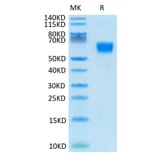 Tris-Bis PAGE - Recombinant Human/Cynomolgus/Rhesus-macaque CD28 Protein (N-terminal Human Fc Tag) (A330294) - Antibodies.com