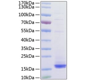 SDS-PAGE - Recombinant Human CD3 Protein (C-terminal His Tag) (A330295) - Antibodies.com