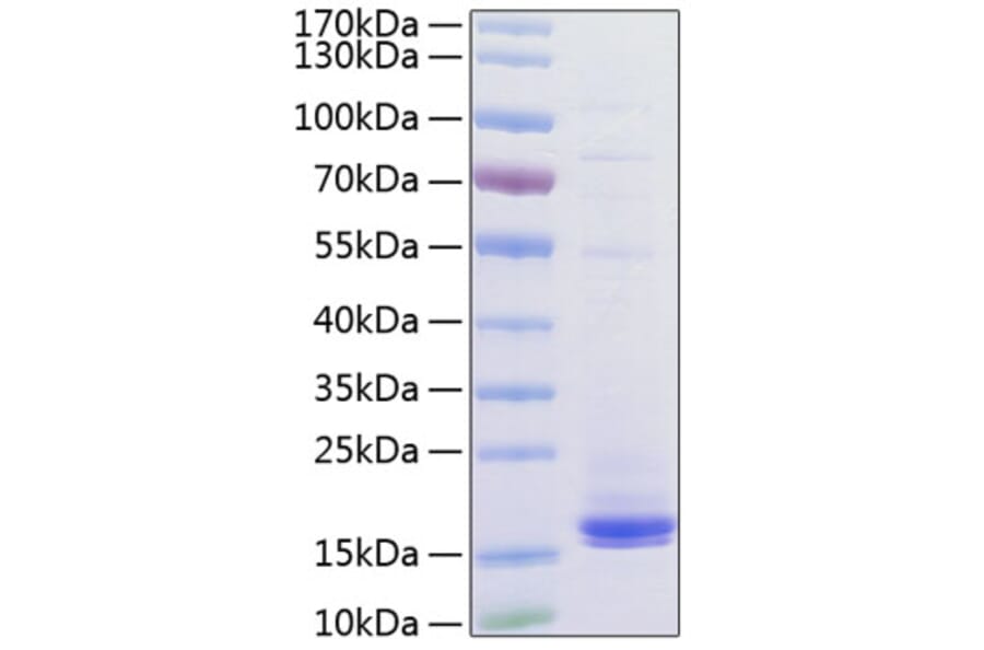 SDS-PAGE - Recombinant Human CD3 Protein (C-terminal His Tag) (A330295) - Antibodies.com