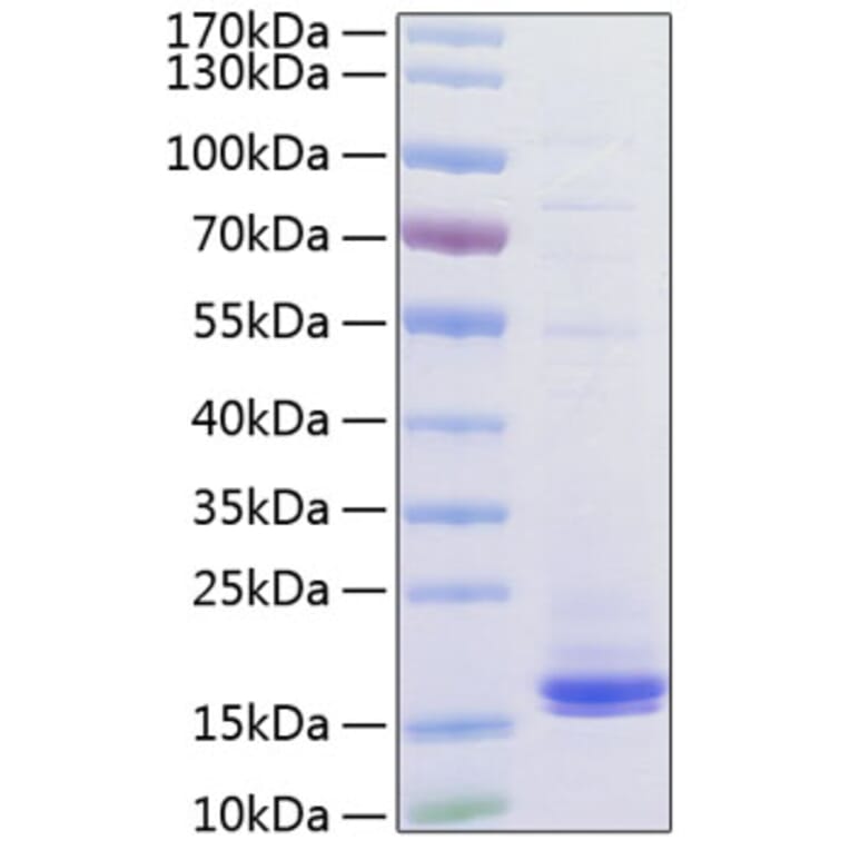 SDS-PAGE - Recombinant Human CD3 Protein (C-terminal His Tag) (A330295) - Antibodies.com