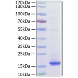 SDS-PAGE - Recombinant Human CD3 Protein (C-terminal His Tag) (A330295) - Antibodies.com