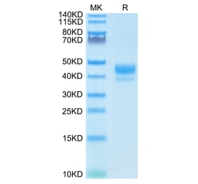 Tris-Bis PAGE - Recombinant Human CD3 Protein (Biotin) (C-terminal Human Fc and Avi Tag) (A330296) - Antibodies.com