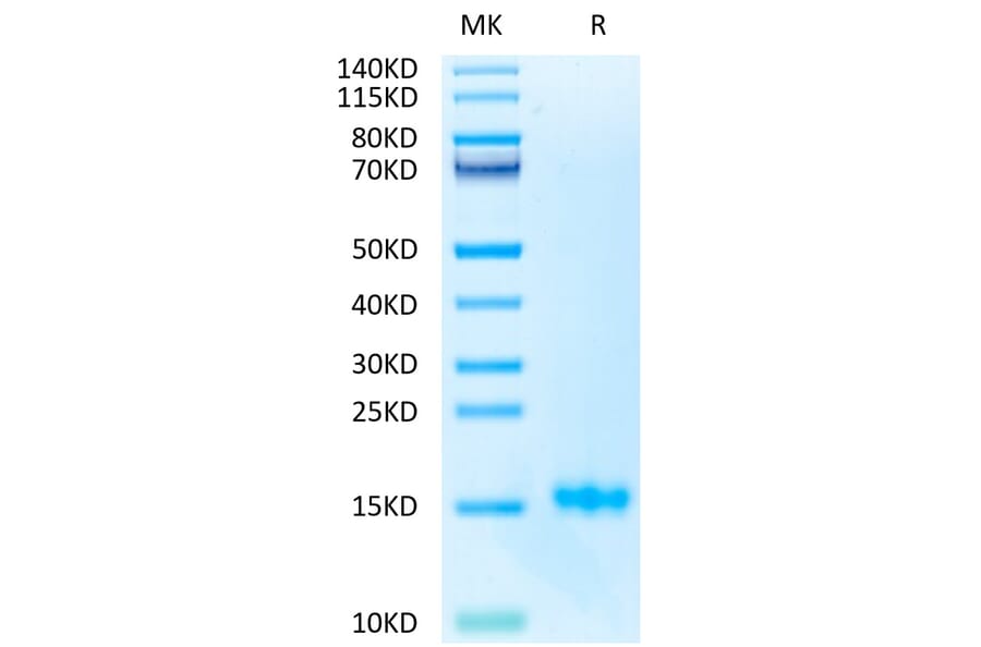 Tris-Bis PAGE - Recombinant Human CD3 Protein (Biotin) (C-terminal His Tag) (A330297) - Antibodies.com