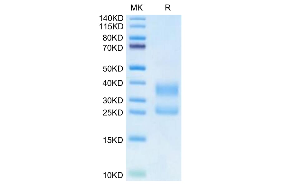 Tris-Bis PAGE - Recombinant Human CD3 + CD3d Protein (Biotin) (C-terminal His Tag) (A330300) - Antibodies.com