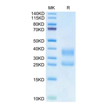 Tris-Bis PAGE - Recombinant Human CD3 + CD3d Protein (Biotin) (C-terminal His Tag) (A330300) - Antibodies.com