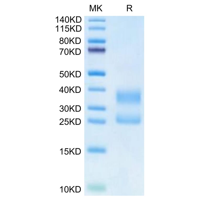 Tris-Bis PAGE - Recombinant Human CD3 + CD3d Protein (Biotin) (C-terminal His Tag) (A330300) - Antibodies.com