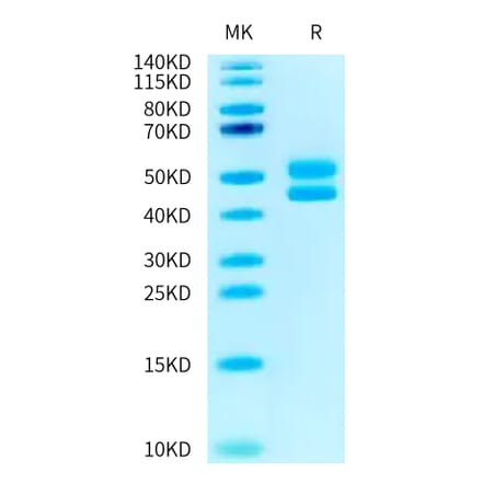 Tris-Bis PAGE - Recombinant Human CD3 + CD3d Protein (C-terminal Human Fc Tag) (A330301) - Antibodies.com