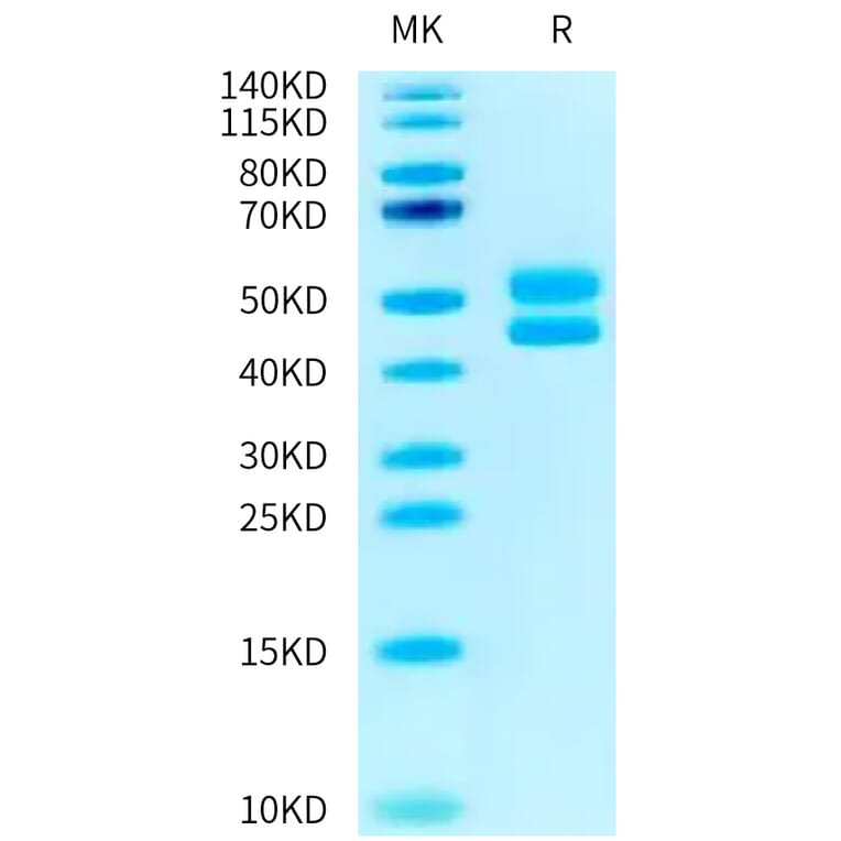 Tris-Bis PAGE - Recombinant Human CD3 + CD3d Protein (C-terminal Human Fc Tag) (A330301) - Antibodies.com