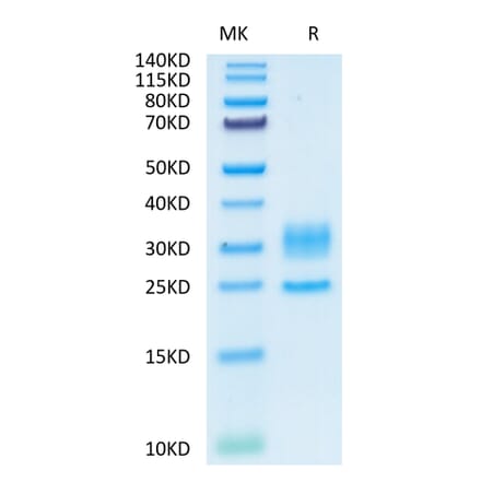Tris-Bis PAGE - Recombinant Human CD3 + CD3d Protein (C-terminal His Tag) (A330302) - Antibodies.com